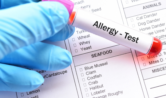 allergy test near me in sarjapur road bangalore