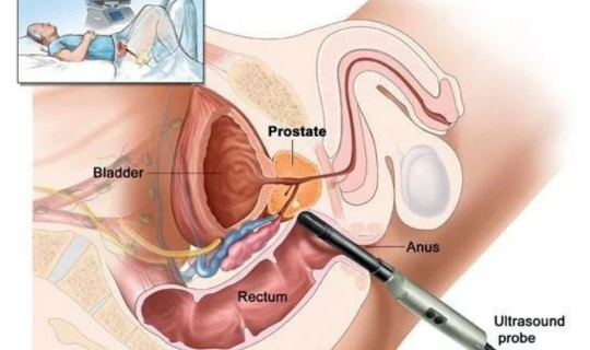 Transperineal Scan Near Me in Sarjapur Road Bangalore