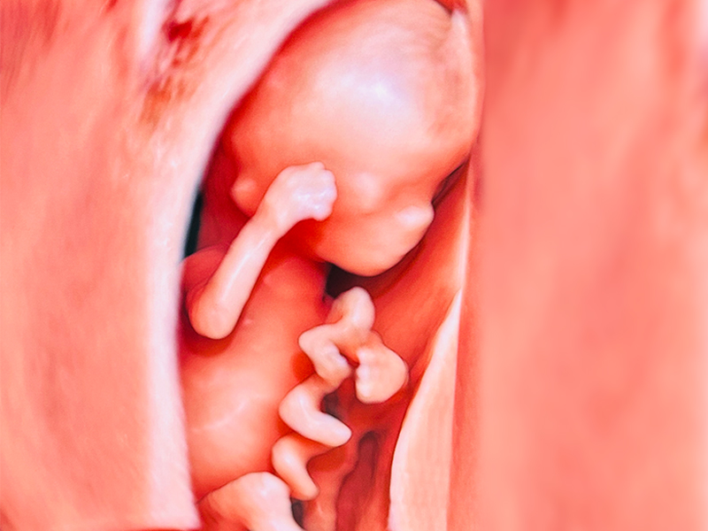 3D & 4D Pregnancy Scans in Bangalore