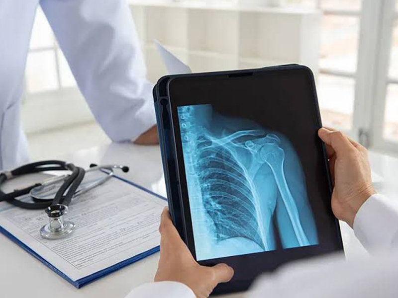 Digital X-ray near me in Sarjapur Road Bangalore