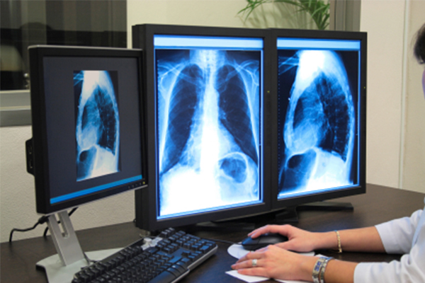 Digital xray in Bangalore