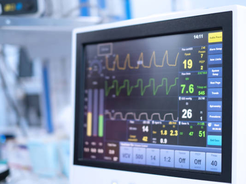 ECG (Electrocardiogram) test in Sarjapur Bangalore