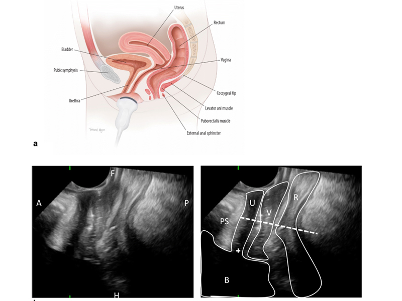 pelvic floor scan in sarjapur bangalore