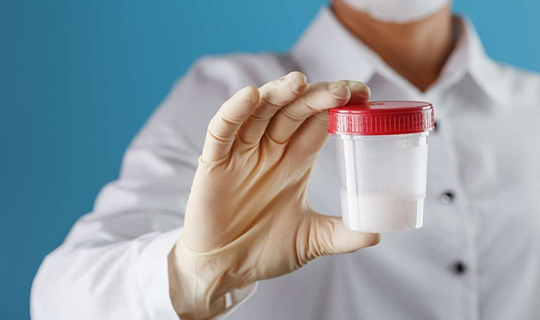 Semen Analysis Test near me Sarjapur Bangalore