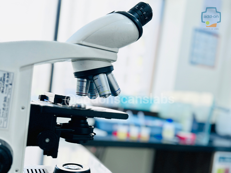 blood test in Bangalore