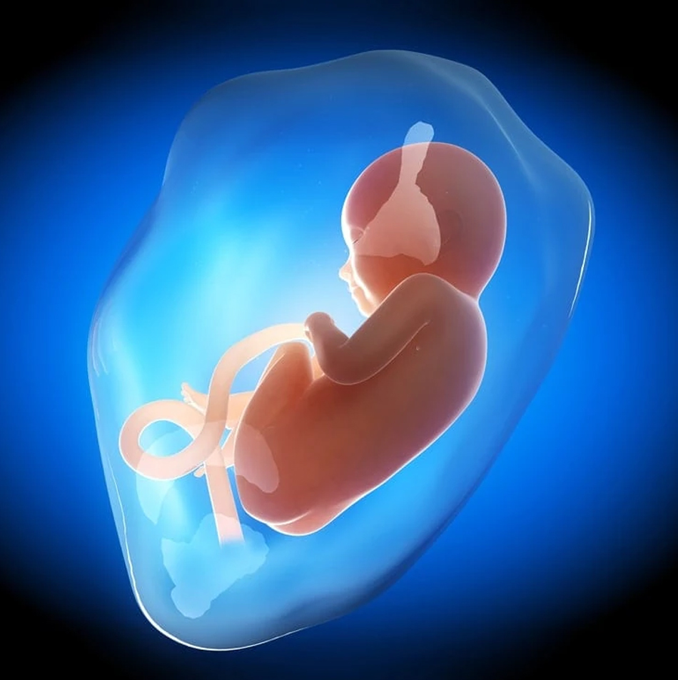 Why Do Amniotic Fluid Levels Matter in Your Pregnancy